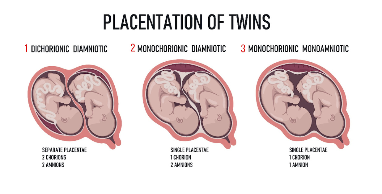 双子の妊娠はいつわかる 双子妊娠の確率や仕組みについて 妊娠 出産 マタニティ情報サイト ニンプス